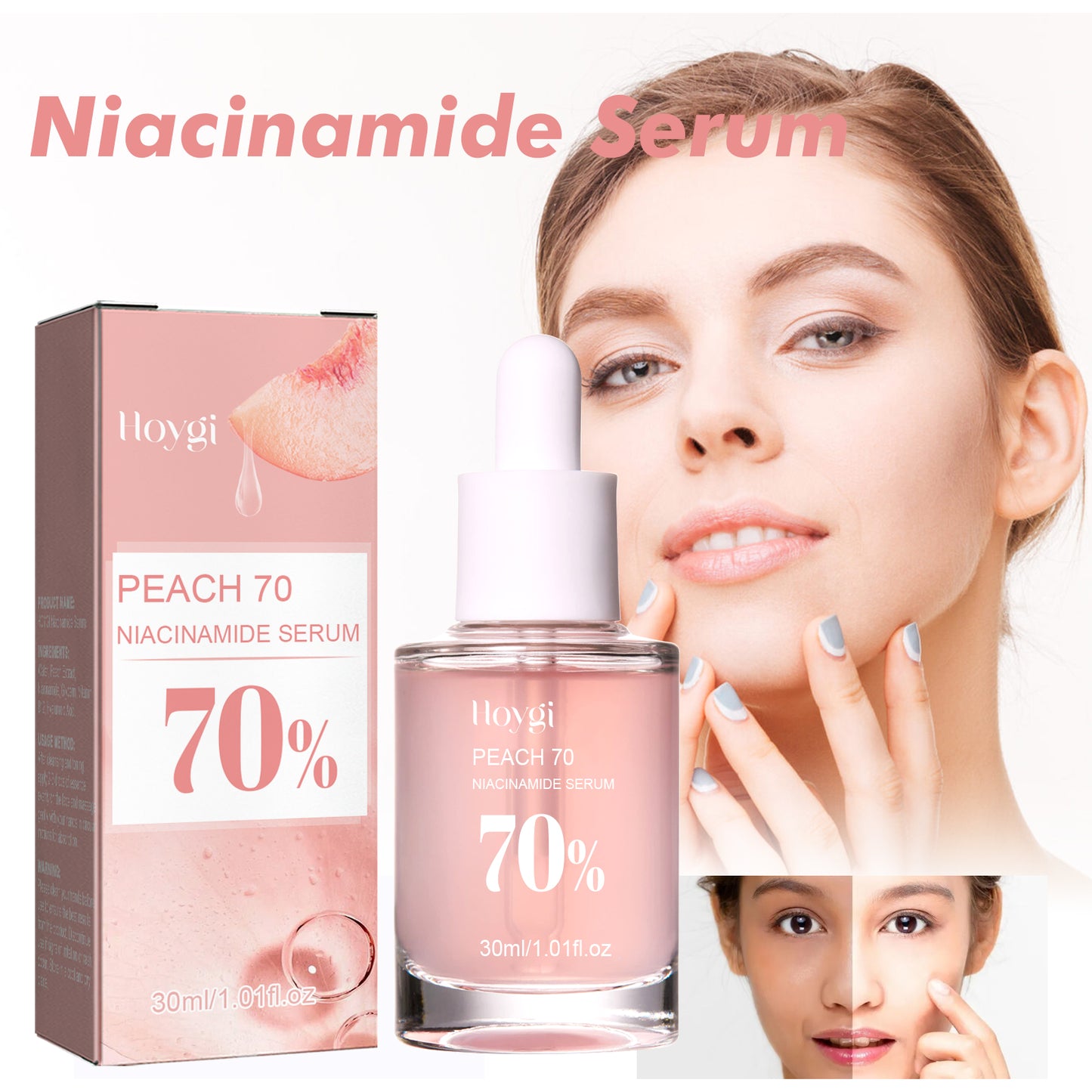 COATHSEA-Niacinamide Essenz – Porenstraffung & Feuchtigkeit, Reduziert Aknenarben & Fältchen