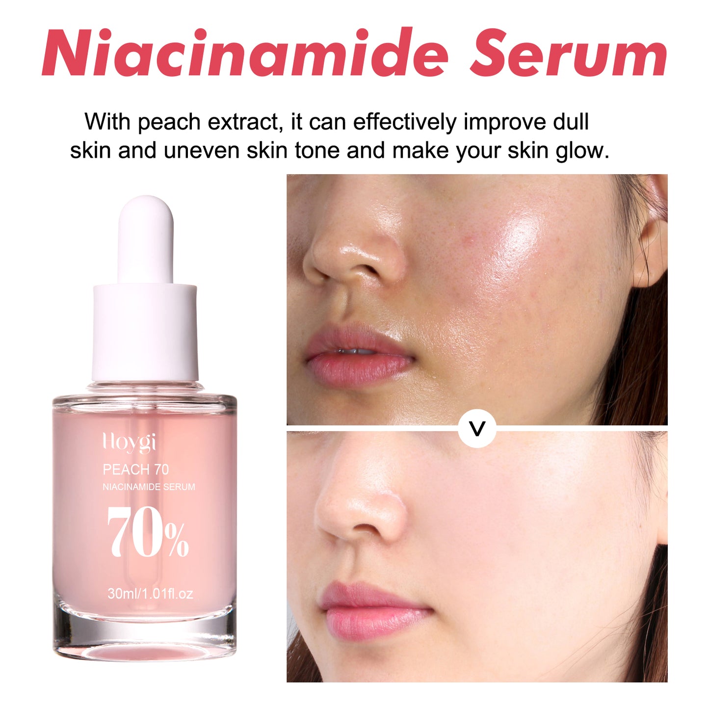 COATHSEA-Niacinamide Essenz – Porenstraffung & Feuchtigkeit, Reduziert Aknenarben & Fältchen