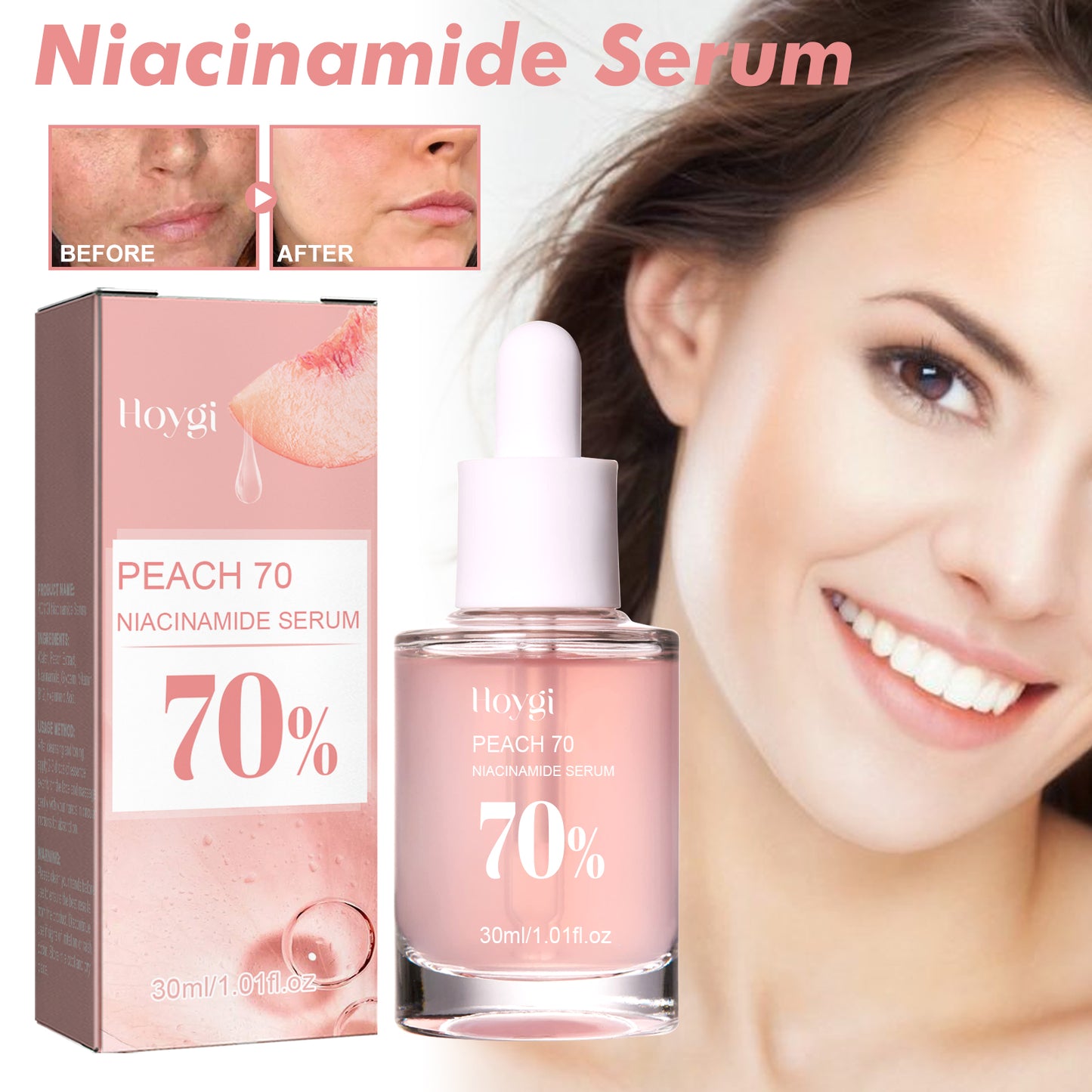 COATHSEA-Niacinamide Essenz – Porenstraffung & Feuchtigkeit, Reduziert Aknenarben & Fältchen