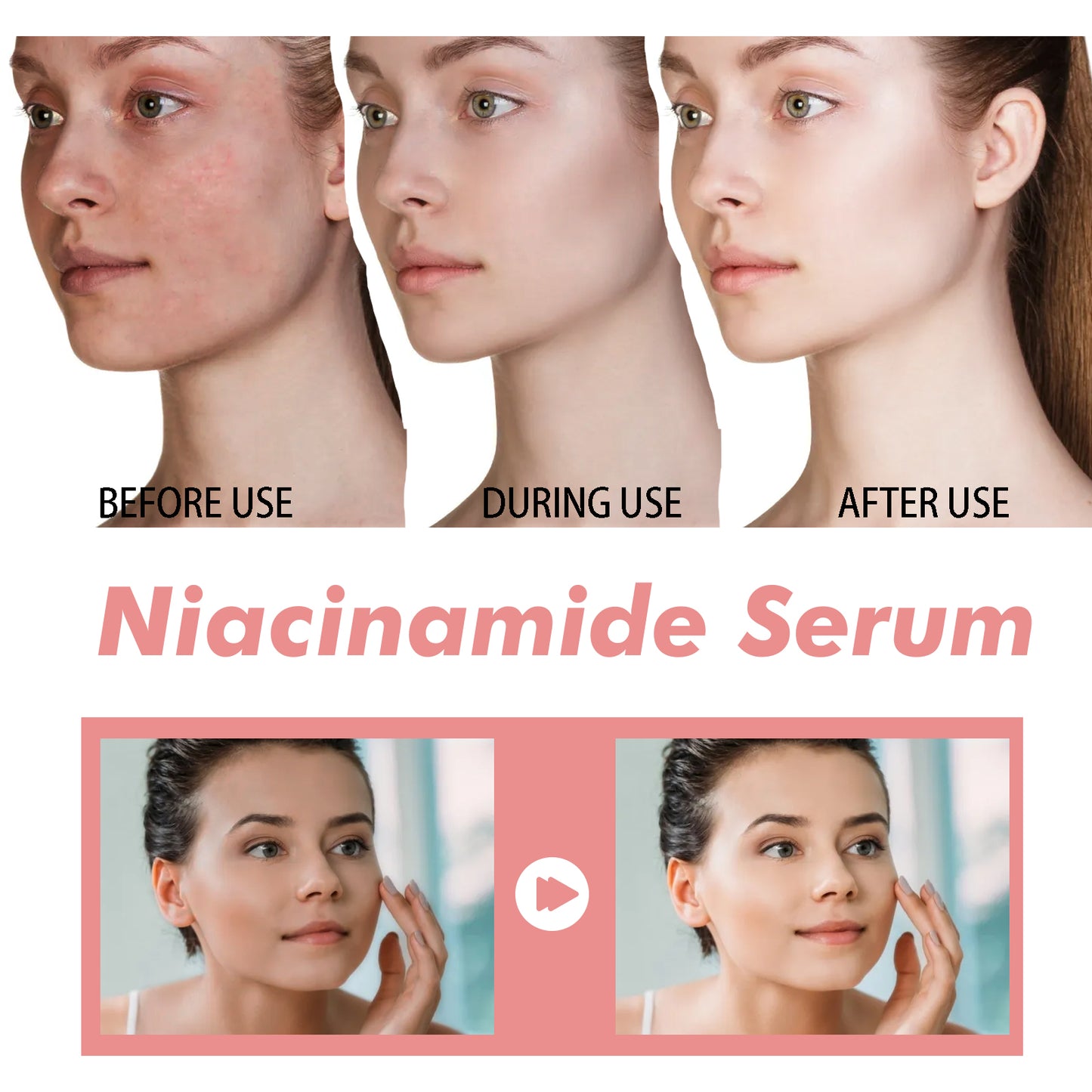 COATHSEA-Niacinamide Essenz – Porenstraffung & Feuchtigkeit, Reduziert Aknenarben & Fältchen